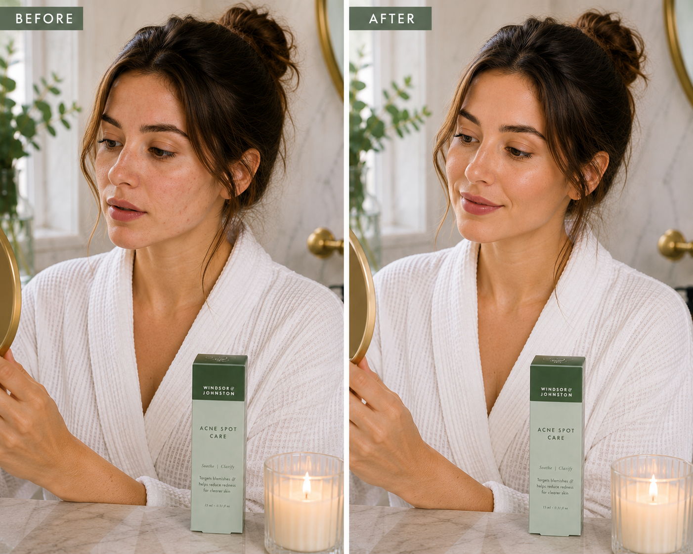 Acne Spot Care